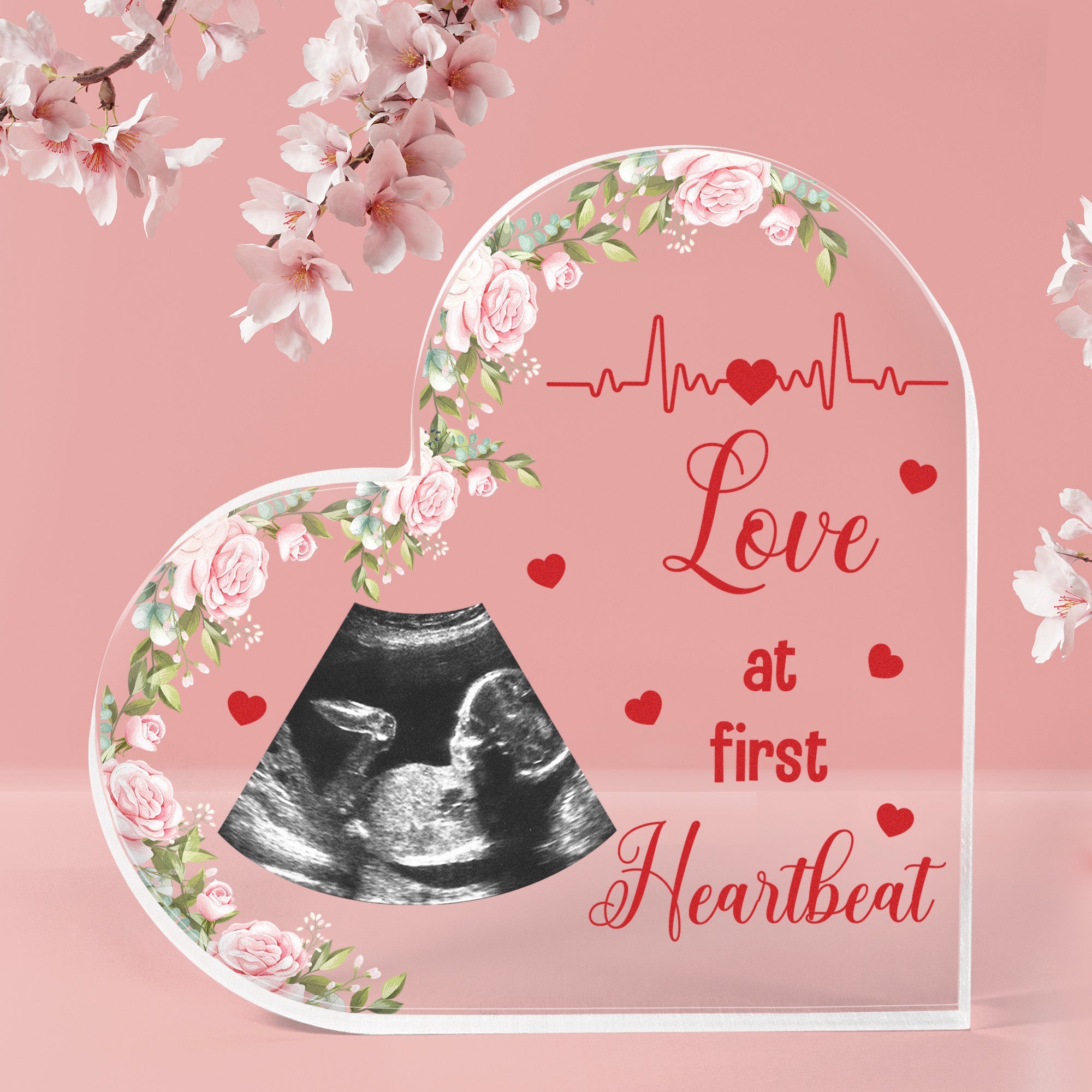 Love At First Heartbeat Baby Ultrasound New Mom - Personalized Photo Acrylic Plaque